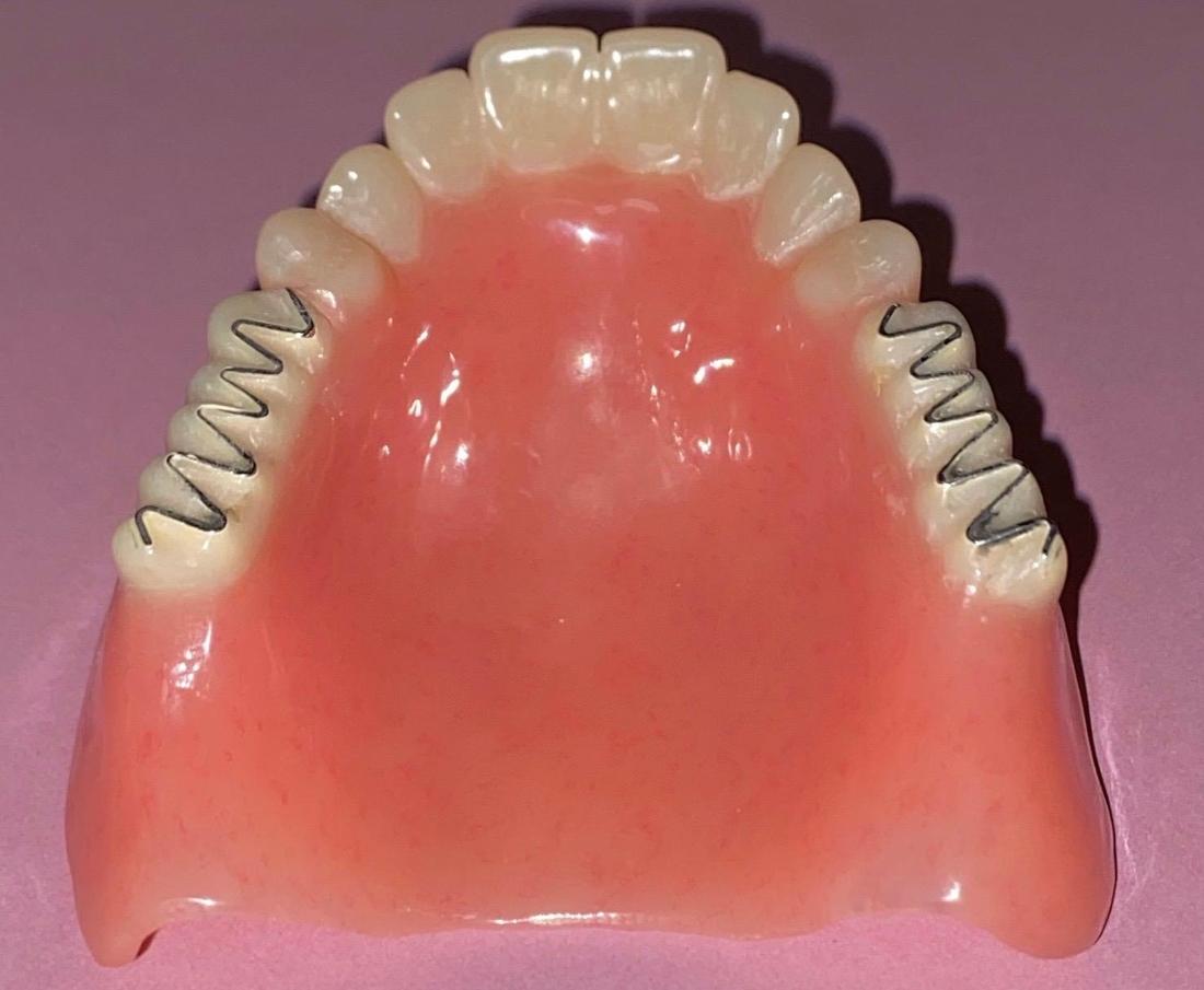 Dixon and Dixon's Smile Gallery Replacing 40 Year Old Dentures